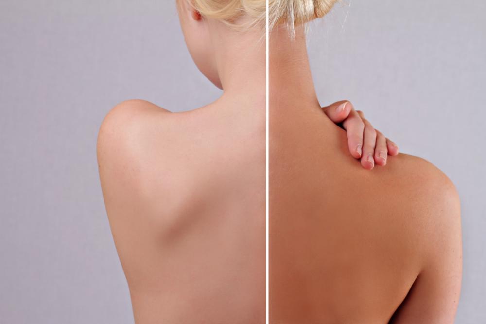 Bronzage sans uv à Samatan